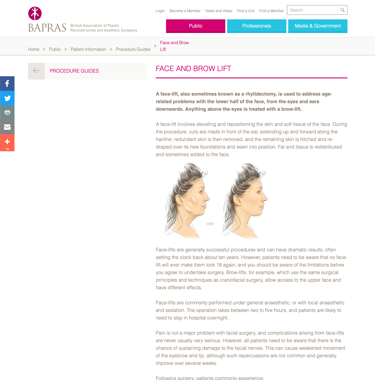 BAPRAS Facelift website patient guidance David Oliver Cosmetic Surgeon